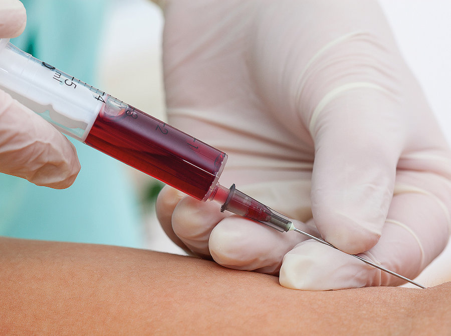 Hematofobia - Miedo a la sangre y su tratamiento