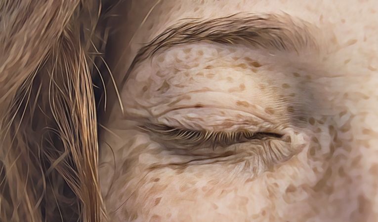 trastorno-dismorfico-corporal-pecas